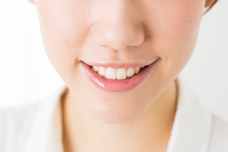 インプラント